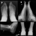 Curso de Radiologia - Posicionamento dos Membros Inferiores