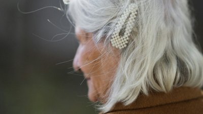 Por que o cabelo fica branco?